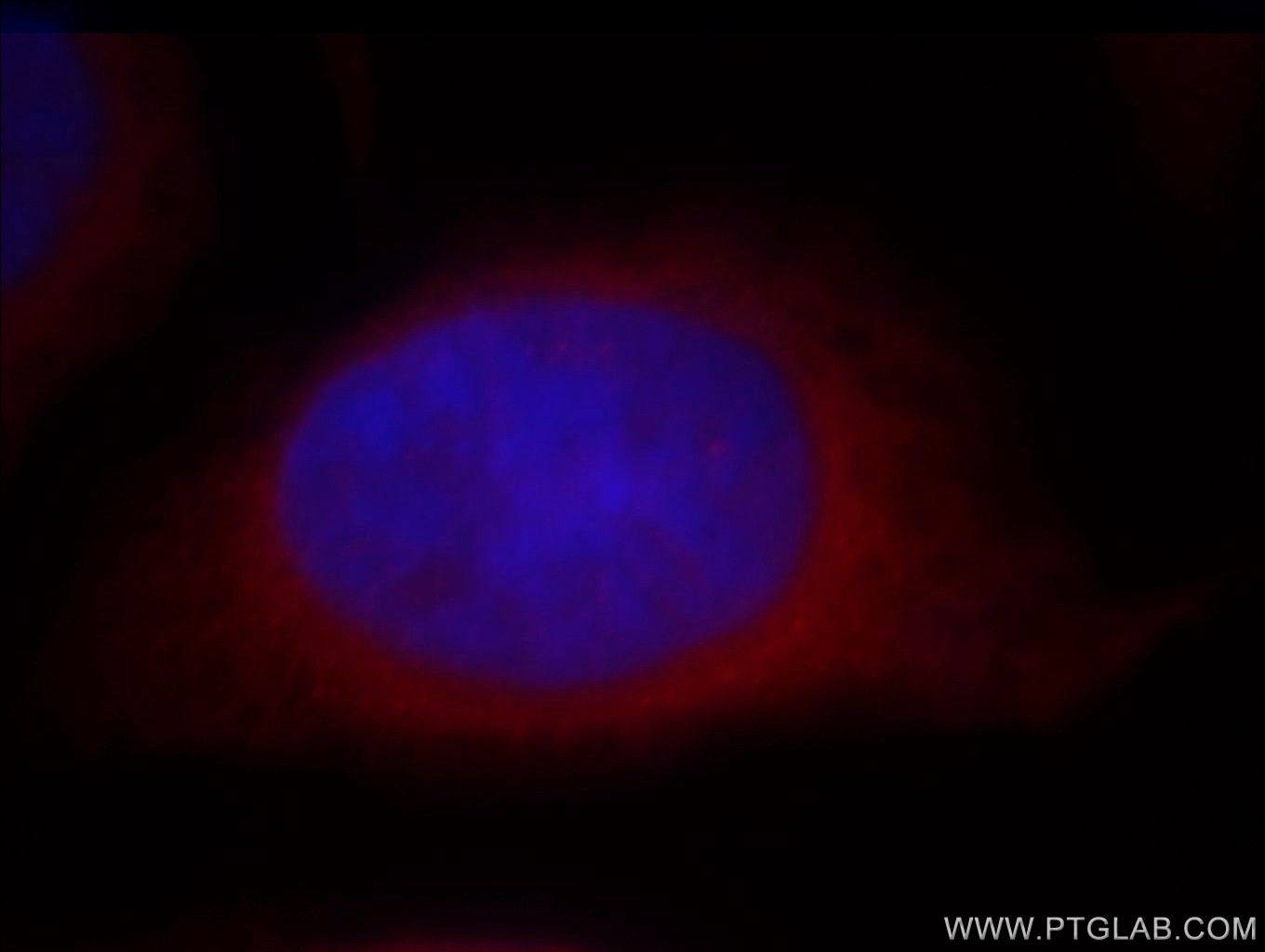 Immunofluorescence (IF) / fluorescent staining of HeLa cells using POMP Polyclonal antibody (15046-1-AP)