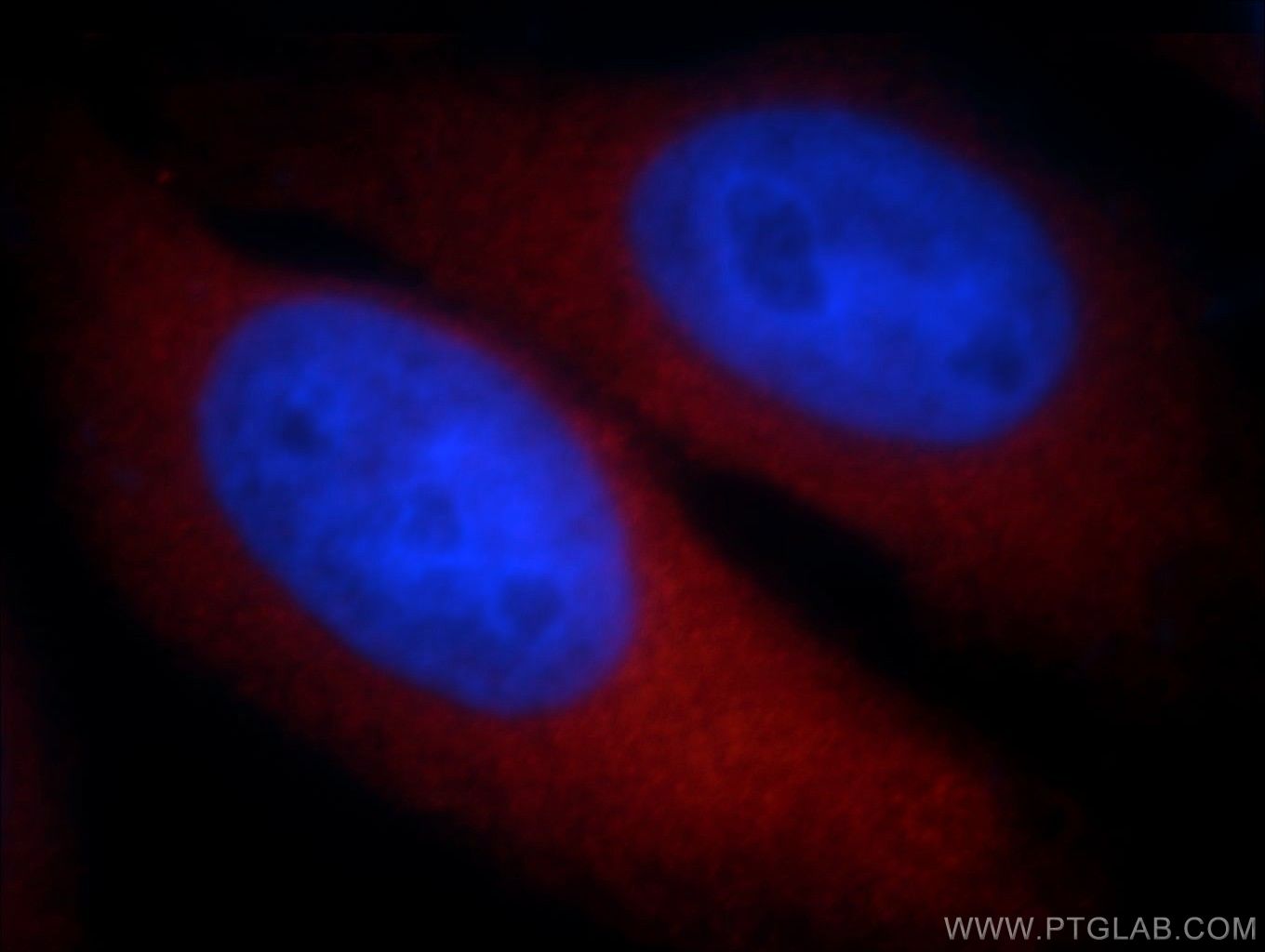 Immunofluorescence (IF) / fluorescent staining of HepG2 cells using POMP Polyclonal antibody (15046-1-AP)
