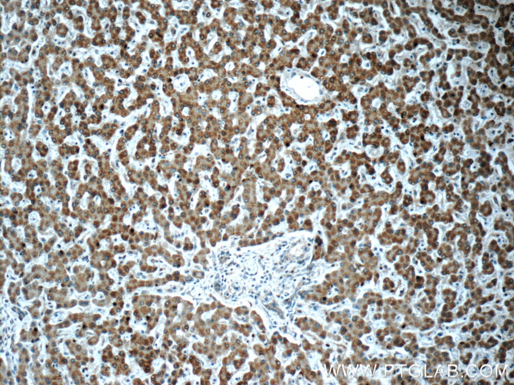 Immunohistochemistry (IHC) staining of human liver tissue using POMP Polyclonal antibody (15046-1-AP)