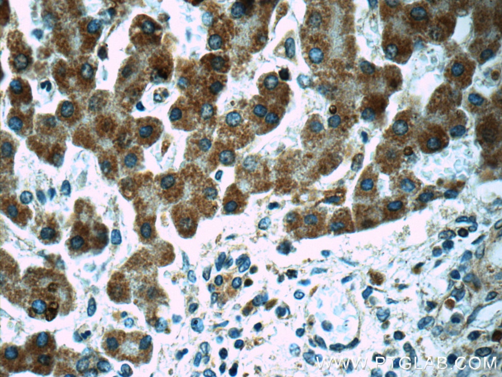 Immunohistochemistry (IHC) staining of human liver tissue using POMP Polyclonal antibody (15046-1-AP)