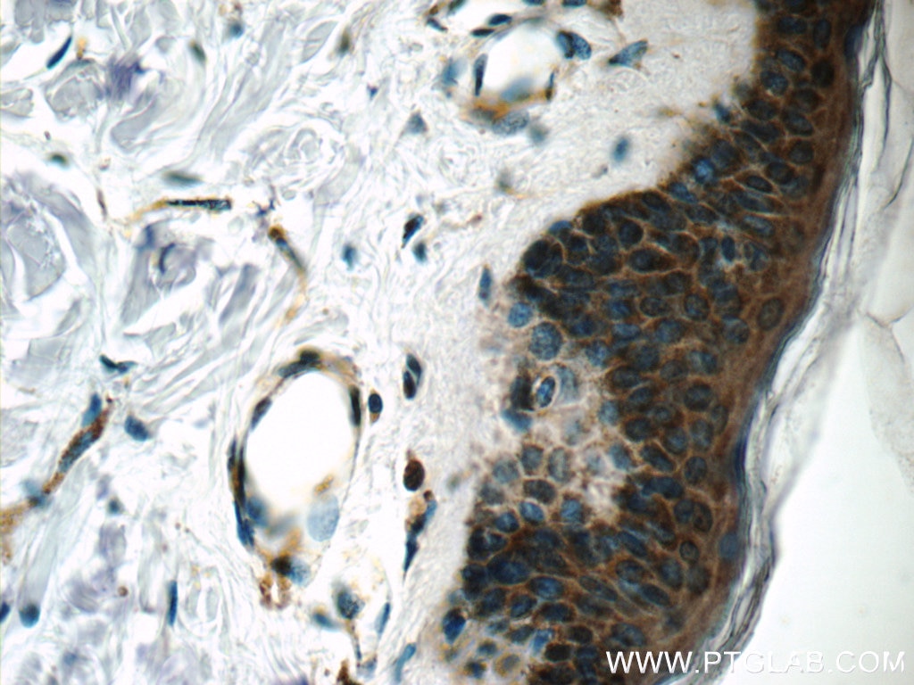 Immunohistochemistry (IHC) staining of human skin tissue using POMP Polyclonal antibody (15046-1-AP)