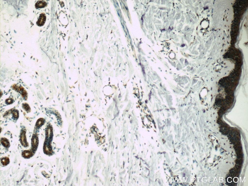 Immunohistochemistry (IHC) staining of human skin tissue using POMP Polyclonal antibody (15046-1-AP)