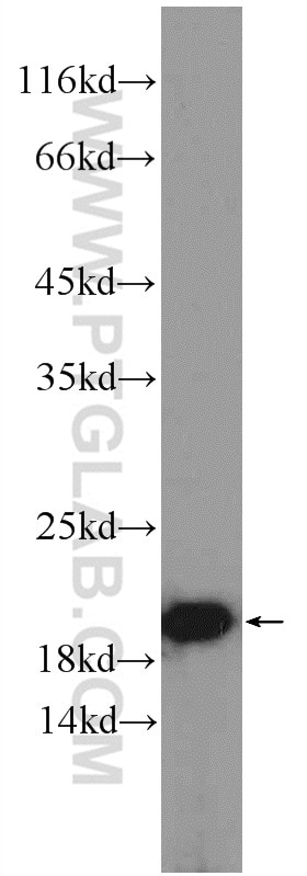 Western Blot (WB) analysis of HeLa cells using POMP Polyclonal antibody (15046-1-AP)