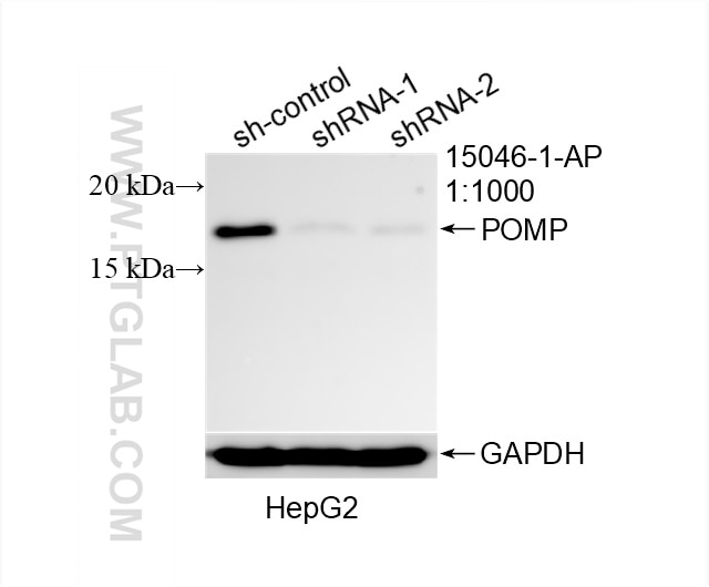 Western Blot (WB) analysis of HepG2 cells using POMP Polyclonal antibody (15046-1-AP)