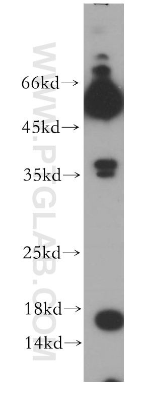 Western Blot (WB) analysis of HepG2 cells using POMP Polyclonal antibody (15046-1-AP)