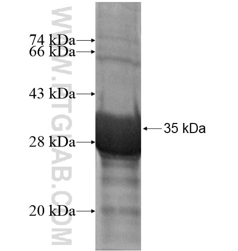 POMT2 fusion protein Ag14409 SDS-PAGE