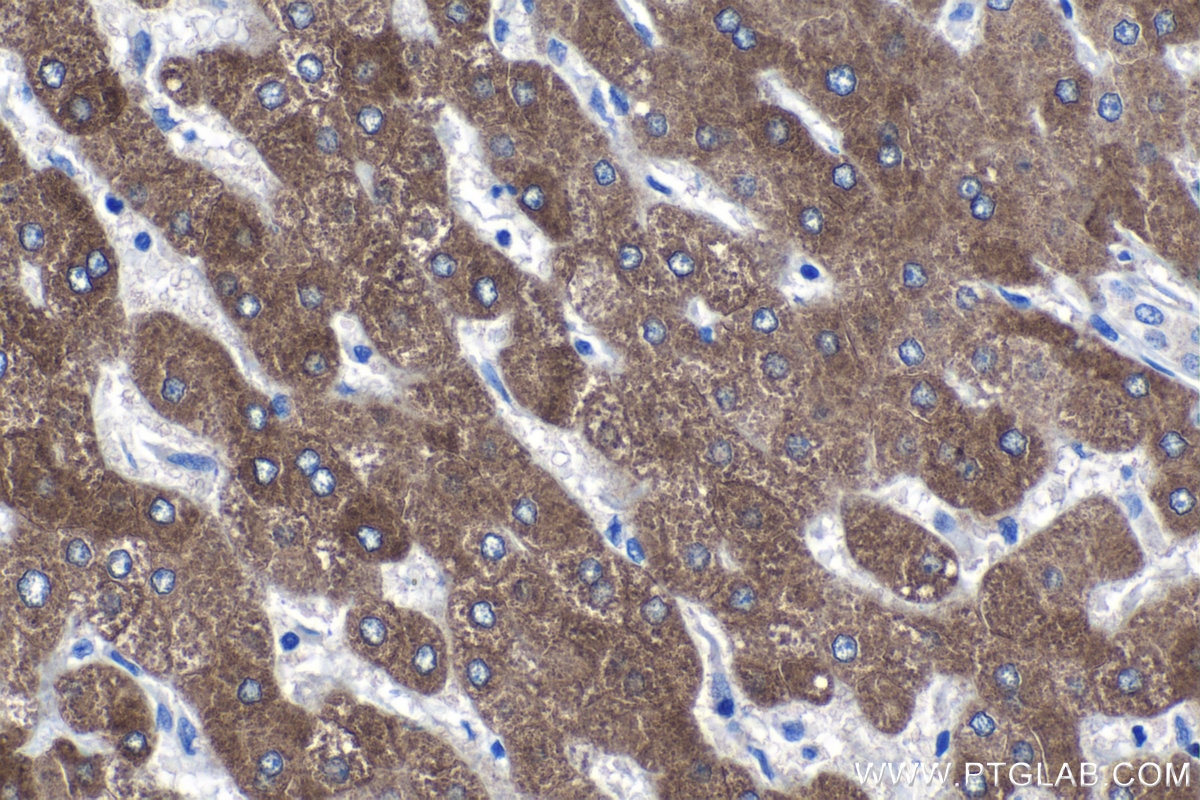 Immunohistochemistry (IHC) staining of human liver tissue using PON1 Polyclonal antibody (18155-1-AP)