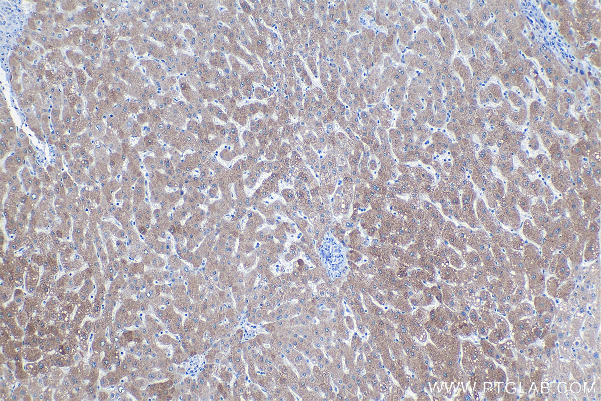 IHC staining of human liver using 18155-1-AP