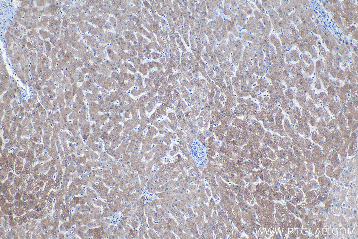 Immunohistochemistry (IHC) staining of human liver tissue using PON1 Polyclonal antibody (18155-1-AP)