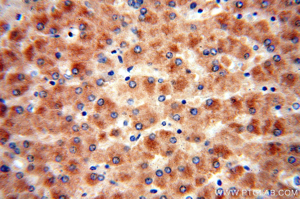 Immunohistochemistry (IHC) staining of human liver tissue using PON1 Polyclonal antibody (18155-1-AP)