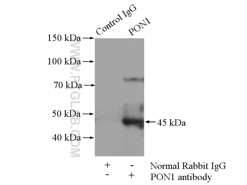 Immunoprecipitation (IP) experiment of mouse liver tissue using PON1 Polyclonal antibody (18155-1-AP)