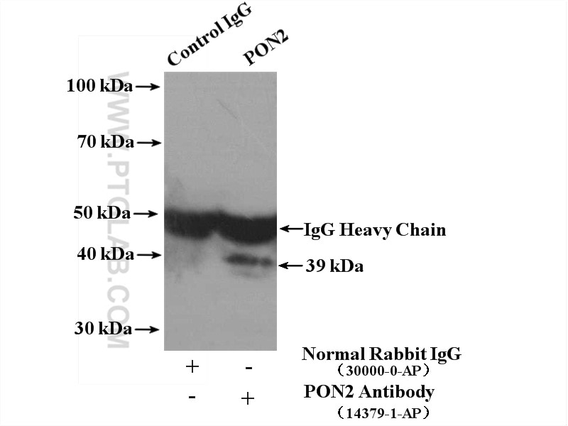 Immunoprecipitation (IP) experiment of L02 cells using PON2 Polyclonal antibody (14379-1-AP)