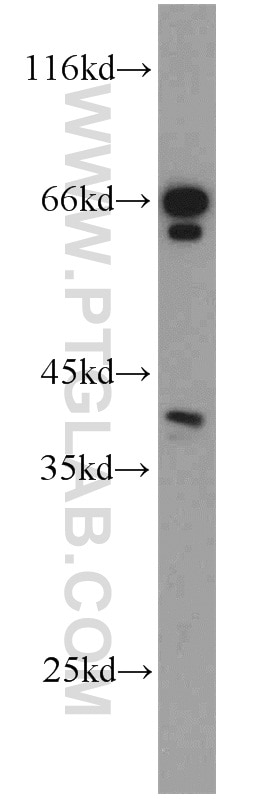 Western Blot (WB) analysis of L02 cells using PON2 Polyclonal antibody (14379-1-AP)