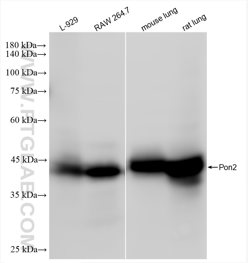 Western Blot (WB) analysis of various lysates using PON2 Recombinant antibody (85126-4-RR)