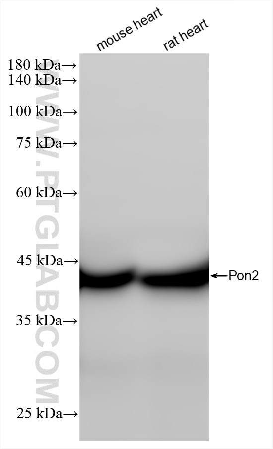 Western Blot (WB) analysis of various lysates using PON2 Recombinant antibody (85126-4-RR)