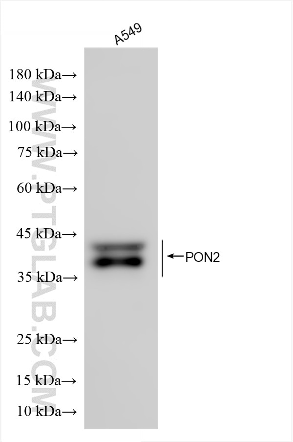 Western Blot (WB) analysis of various lysates using PON2 Recombinant antibody (86347-3-RR)