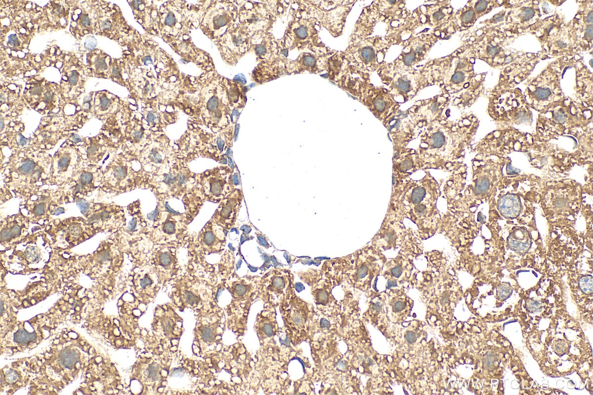 Immunohistochemistry (IHC) staining of mouse liver tissue using PON3 Polyclonal antibody (31793-1-AP)
