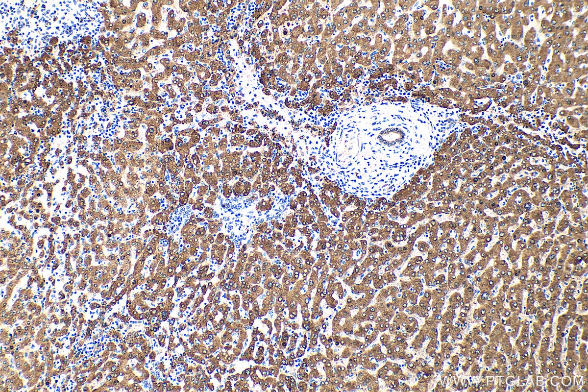 Immunohistochemistry (IHC) staining of human liver tissue using PON3 Polyclonal antibody (31793-1-AP)