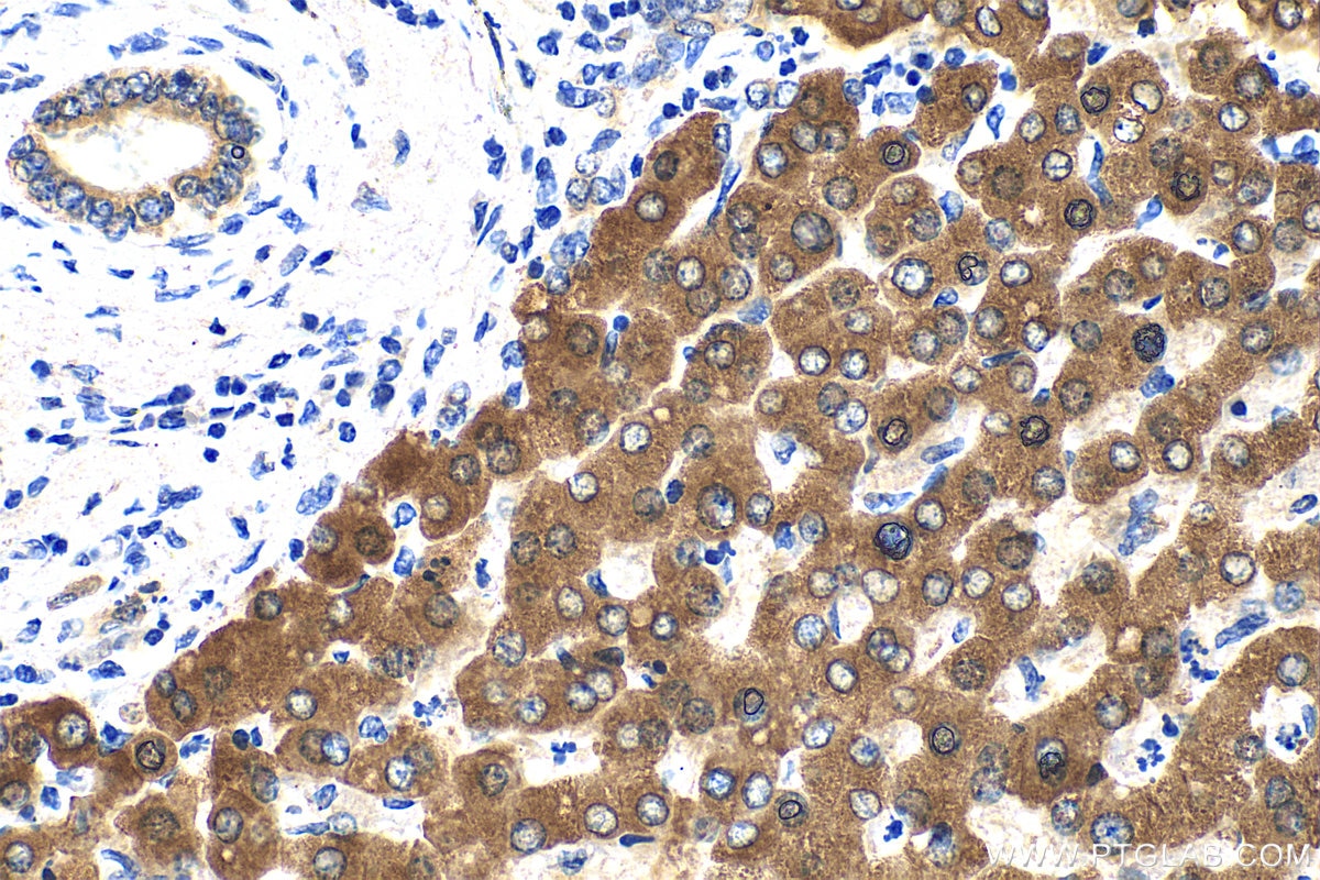 Immunohistochemistry (IHC) staining of human liver tissue using PON3 Polyclonal antibody (31793-1-AP)