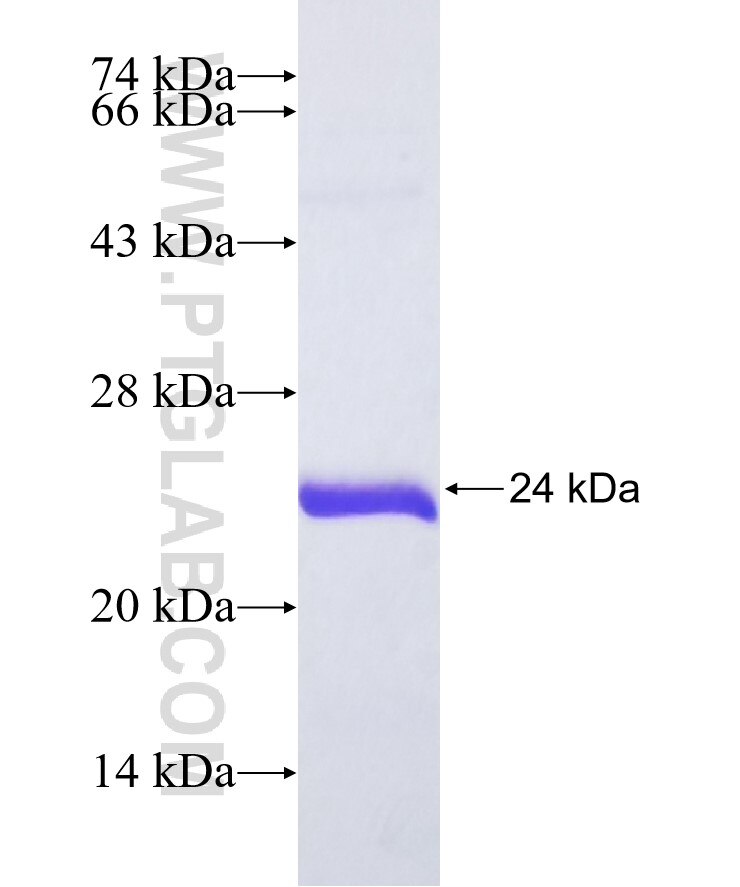 PON3 fusion protein Ag36624 SDS-PAGE PON3 fusion protein Ag36624 SDS-PAGE