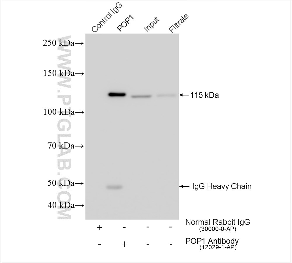 Immunoprecipitation (IP) experiment of HeLa cells using POP1 Polyclonal antibody (12029-1-AP)
