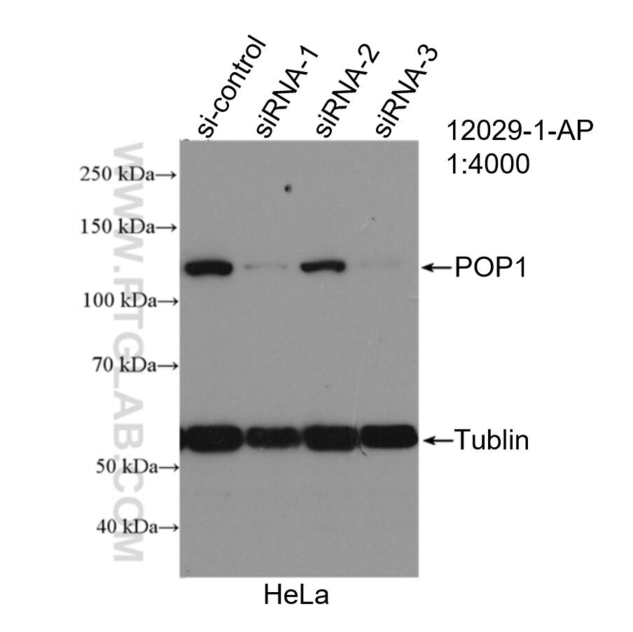 Western Blot (WB) analysis of HeLa cells using POP1 Polyclonal antibody (12029-1-AP)
