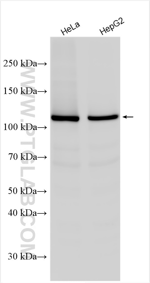 Western Blot (WB) analysis of various lysates using POP1 Polyclonal antibody (12029-1-AP)