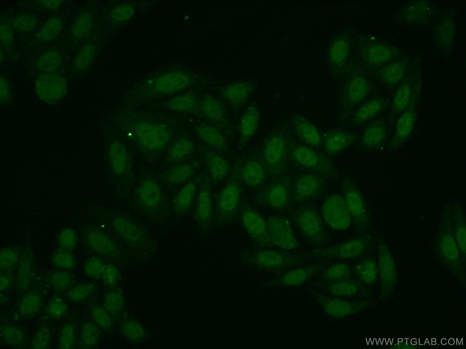 Immunofluorescence (IF) / fluorescent staining of HepG2 cells using POP4 Polyclonal antibody (15273-1-AP)