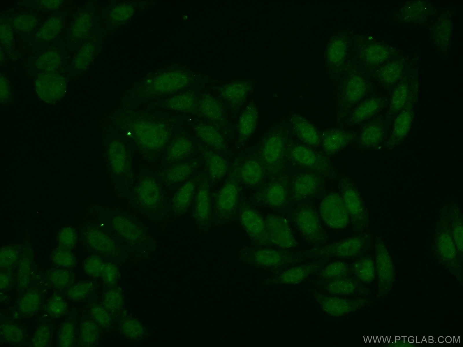 IF Staining of HepG2 using 15273-1-AP