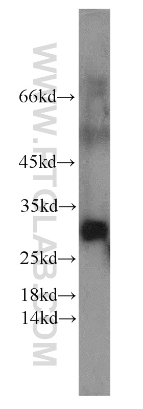 WB analysis of HepG2 using 15273-1-AP