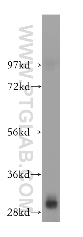 Western Blot (WB) analysis of HeLa cells using POP4 Polyclonal antibody (15273-1-AP)