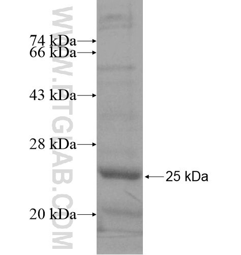 POP5 fusion protein Ag15181 SDS-PAGE