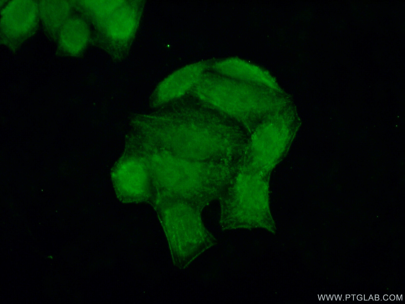 Immunofluorescence (IF) / fluorescent staining of HeLa cells using POP7 Polyclonal antibody (14964-1-AP)