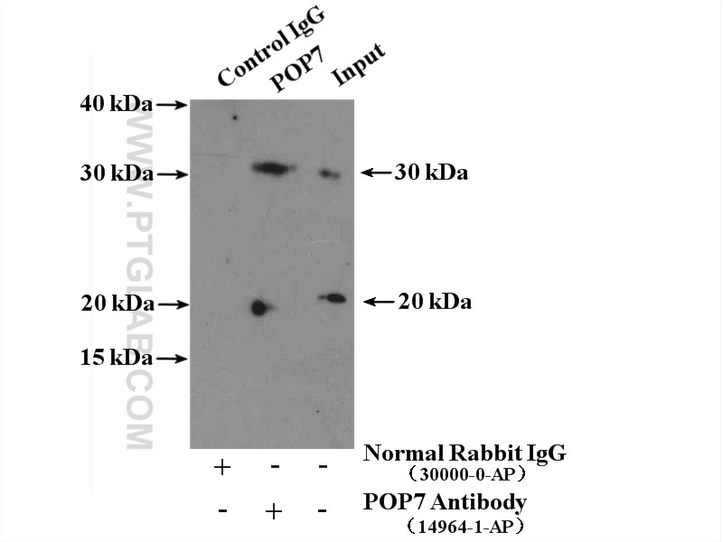 Immunoprecipitation (IP) experiment of HeLa cells using POP7 Polyclonal antibody (14964-1-AP)