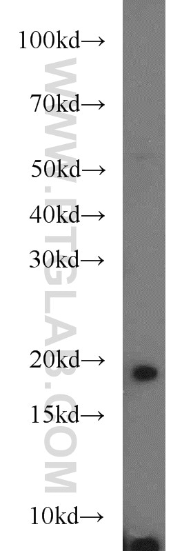 Western Blot (WB) analysis of HeLa cells using POP7 Polyclonal antibody (14964-1-AP)