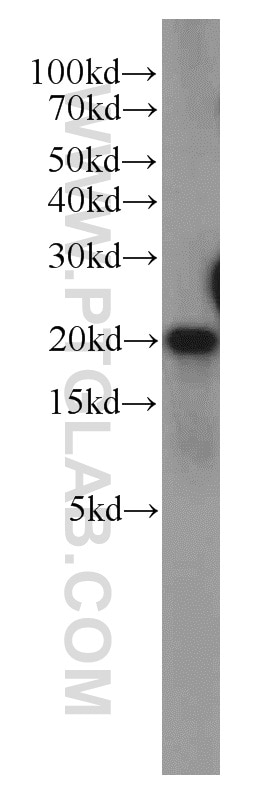 Western Blot (WB) analysis of HeLa cells using POP7 Polyclonal antibody (14964-1-AP)
