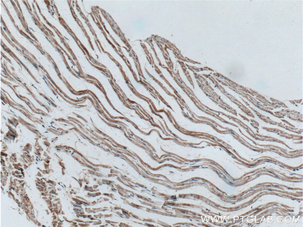 Immunohistochemistry (IHC) staining of mouse heart tissue using POPDC3 Polyclonal antibody (11800-1-AP)