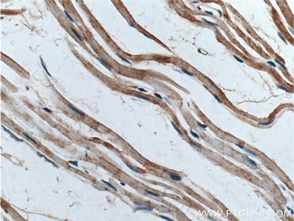 Immunohistochemistry (IHC) staining of mouse heart tissue using POPDC3 Polyclonal antibody (11800-1-AP)
