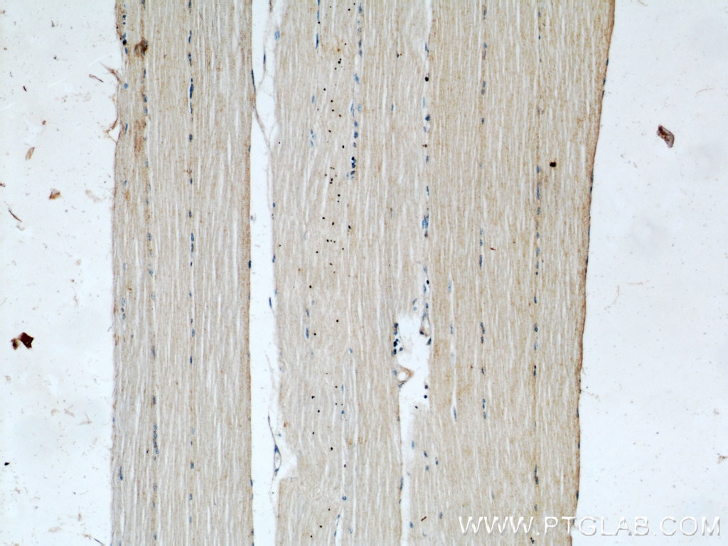 IHC staining of human skeletal muscle using 11800-1-AP