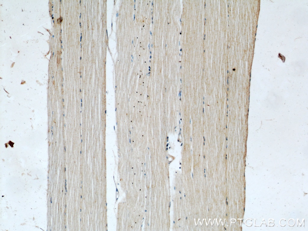 Immunohistochemistry (IHC) staining of human skeletal muscle tissue using POPDC3 Polyclonal antibody (11800-1-AP)