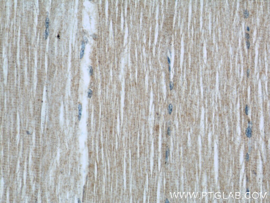 Immunohistochemistry (IHC) staining of human skeletal muscle tissue using POPDC3 Polyclonal antibody (11800-1-AP)