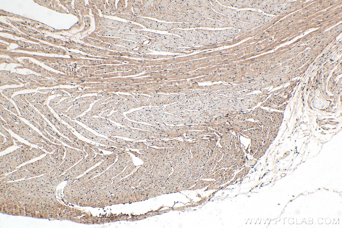 Immunohistochemistry (IHC) staining of mouse heart tissue using POPDC3 Polyclonal antibody (11800-1-AP)