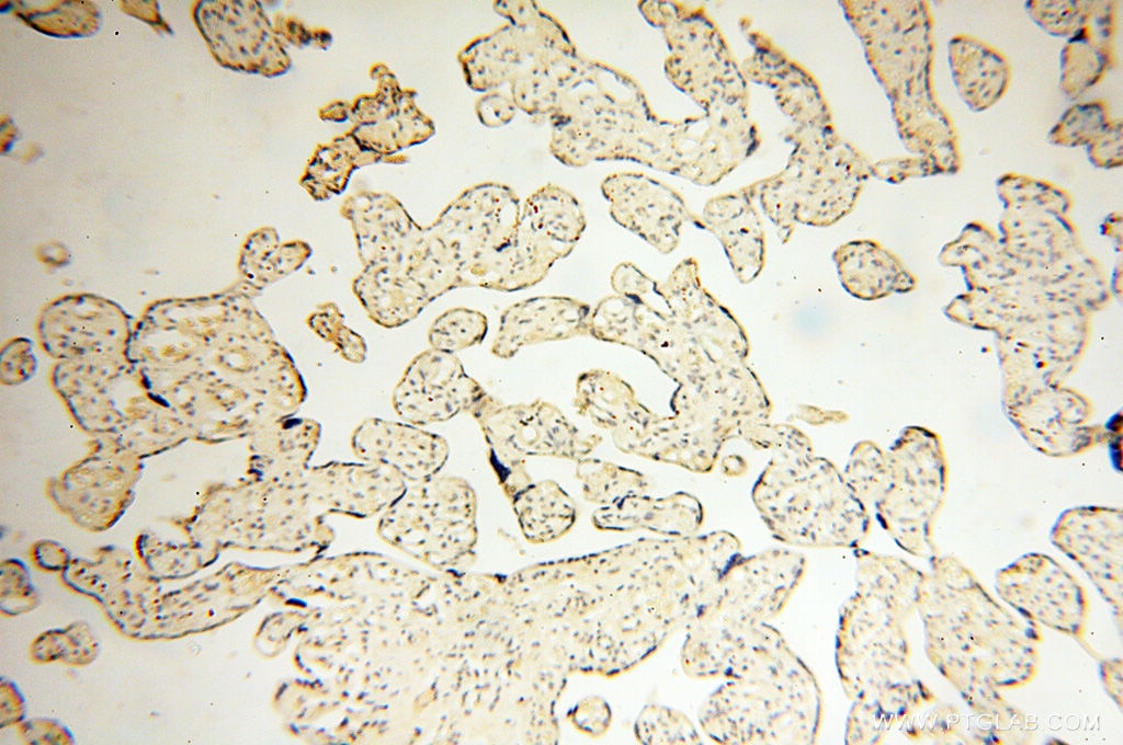 Immunohistochemistry (IHC) staining of human placenta tissue using POPDC3 Polyclonal antibody (11800-1-AP)