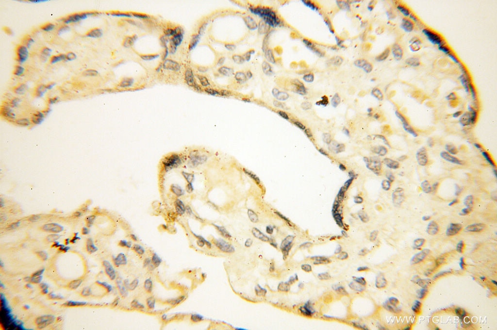 Immunohistochemistry (IHC) staining of human placenta tissue using POPDC3 Polyclonal antibody (11800-1-AP)