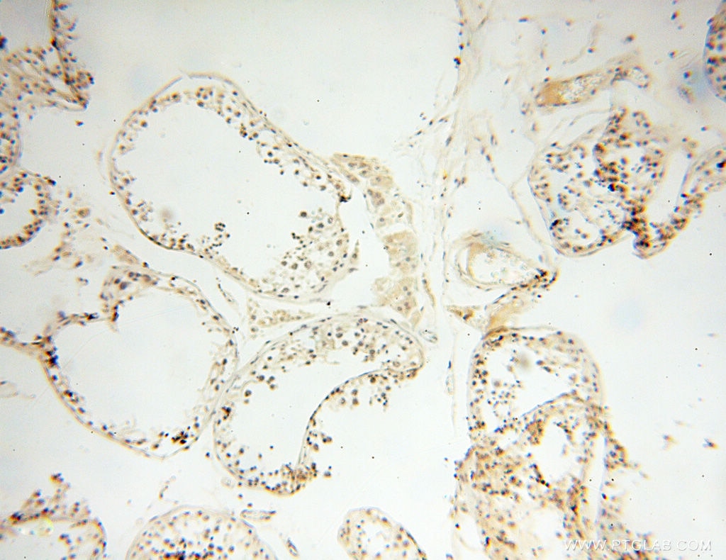 Immunohistochemistry (IHC) staining of human testis tissue using POPDC3 Polyclonal antibody (11800-1-AP)