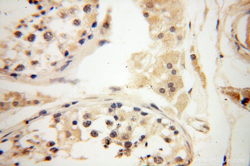 Immunohistochemistry (IHC) staining of human testis tissue using POPDC3 Polyclonal antibody (11800-1-AP)