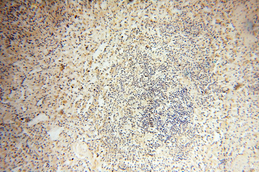 Immunohistochemistry (IHC) staining of human spleen tissue using POPDC3 Polyclonal antibody (11800-1-AP)
