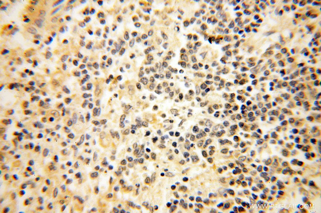 IHC staining of human spleen using 11800-1-AP