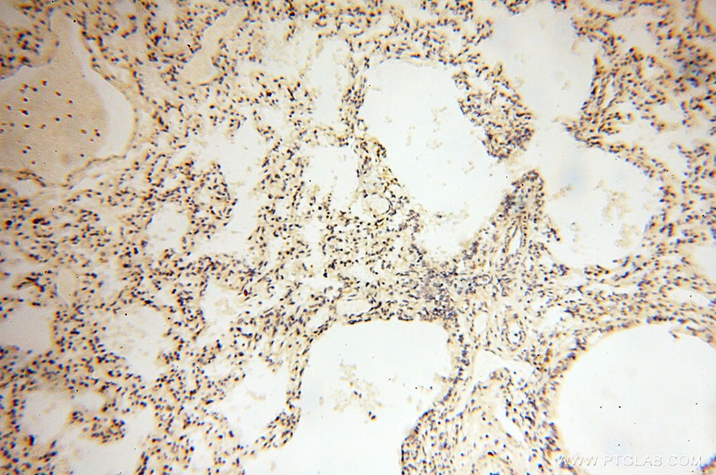 IHC staining of human lung using 11800-1-AP