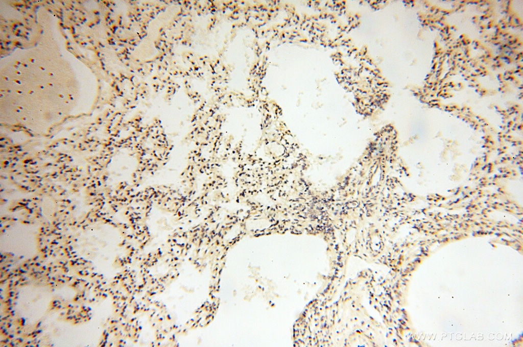 Immunohistochemistry (IHC) staining of human lung tissue using POPDC3 Polyclonal antibody (11800-1-AP)